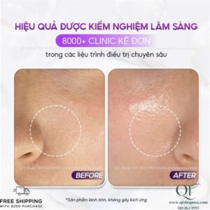 Pharmesthetics CONAPIDIL CEMENSHEET: Mask Định Vị xanh Mặt Nạ Thải Độc & Phục Hồi - Image 4