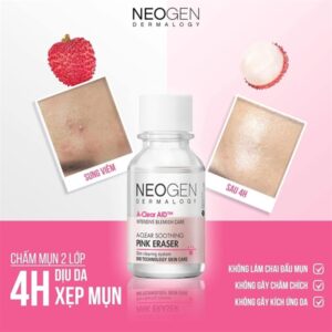 Chấm Mụn Neogen - Hộp - Image 1