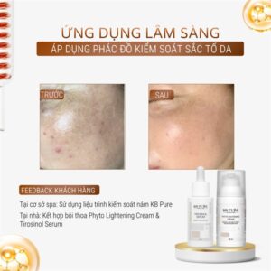 *KB PURE - Serum Trắng Da Tirosinol 30ml - EXP 202811 - Image 3